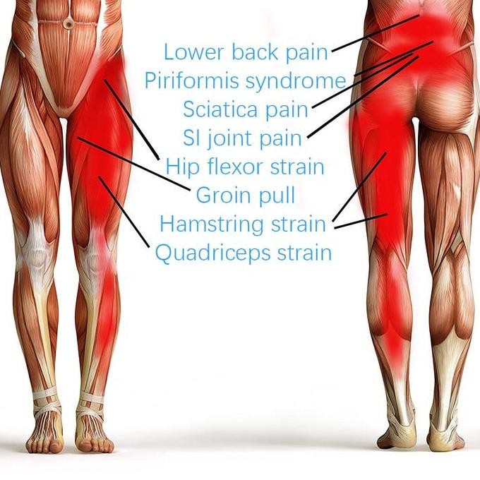 Ori - Deker Paha Thigh Brace Support Strap Penyangga Pinggul Cedera Olahraga Terapi