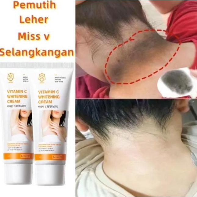 Promo / Terlaris Pemutih leher dan pundak ORI Krim pemutih Vitamin C Pemutih selangkangan hitam perm