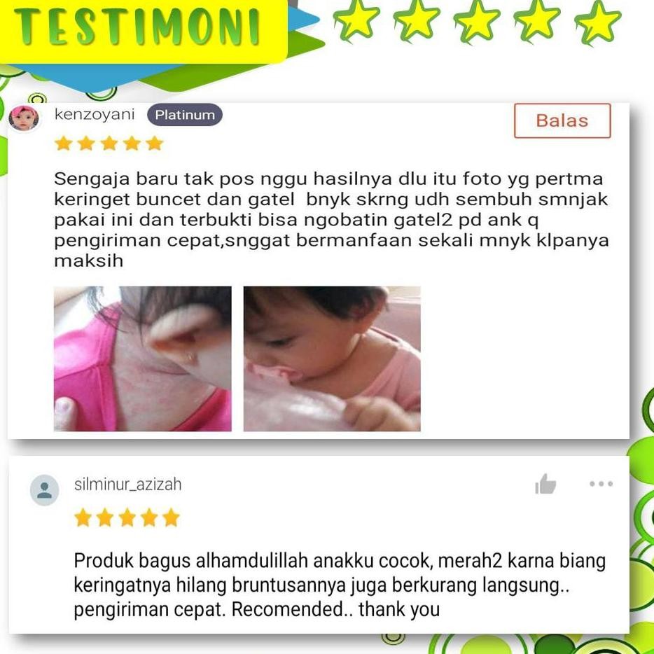 Kekinian OBAT EKSIM DERMATITIS RUAM POPOK KULIT BERKERAK BIANG KERINGAT BAYI ALAMI ABYAZ BABY CARE O