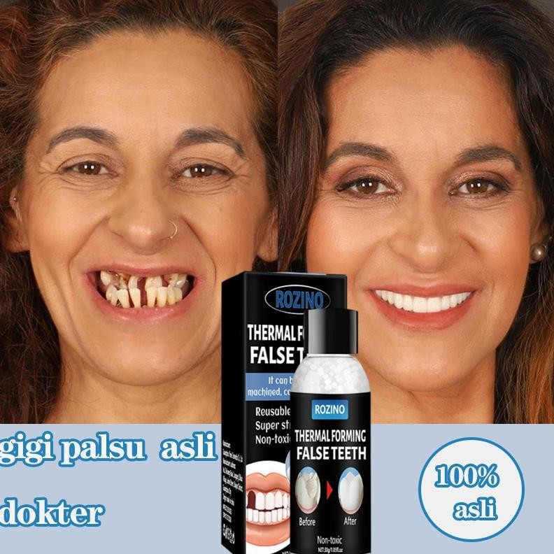 Penambal gigi Tambal gigi Gigi palsu Tambal gigi permanen Penambal gigi berlubang 30ml Penambal gigi
