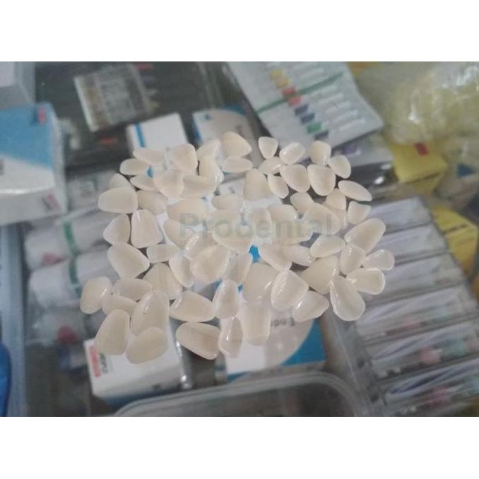 Original Crown Gigi Veneer Isi 50pcs - Warna A2 Gigi Tiruan Veneer Dental
