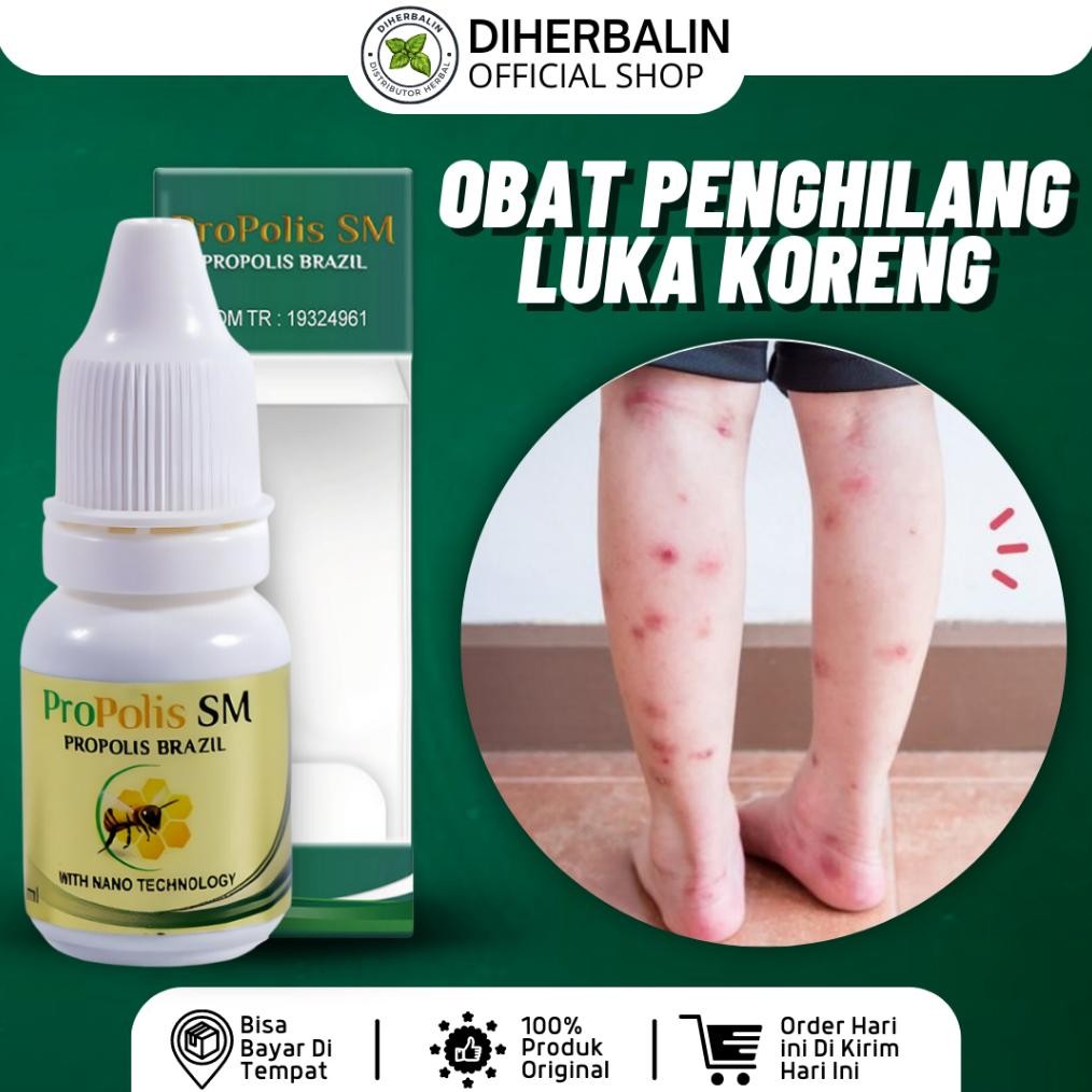 ProPolis SM 6ml - Obat Koreng, Obat Koreng Di Kaki, Penghilang Bekas Luka Hitam Koreng, Penghilang B