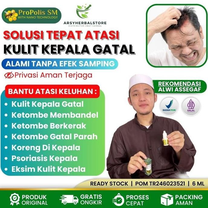 Herbal Untuk Kulit Kepala Gatal, Gatal Kulit Kepala, Psioriasis, Jamur Di Kulit Kepala - Propolis SM