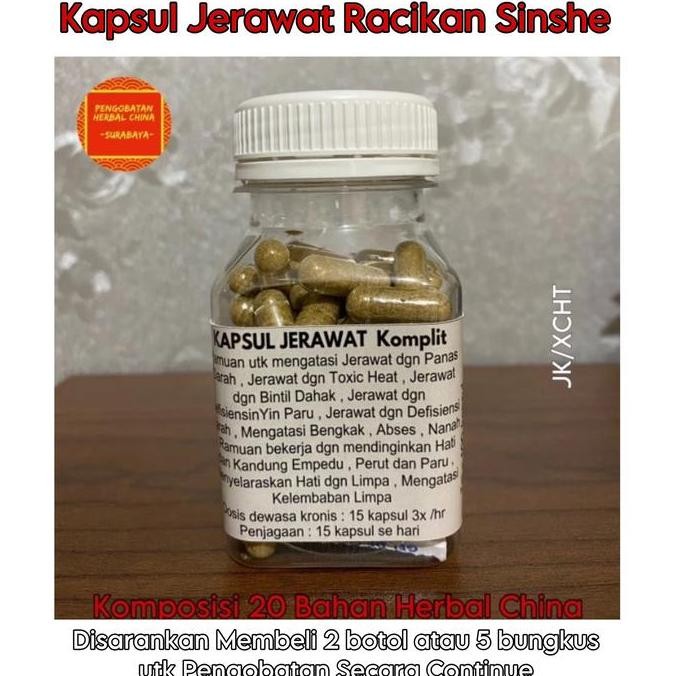TERLARIS - Obat Cina Sinshe JERAWAT SUPER Ampuh Super Komplit