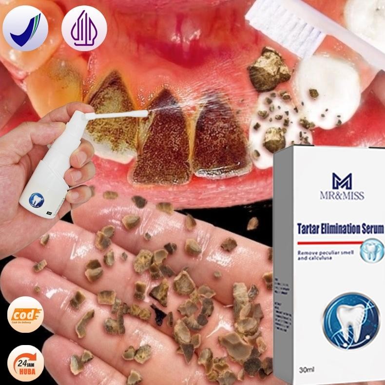 Perontok karang gigi paling ampuh Pembersih karang gigi Penghilang karang gigi 30ml Perontok karang 