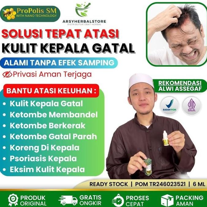 TERMURAH - Herbal Untuk Kulit Kepala Gatal, Gatal Kulit Kepala, Psioriasis, Jamur Di Kulit Kepala - 