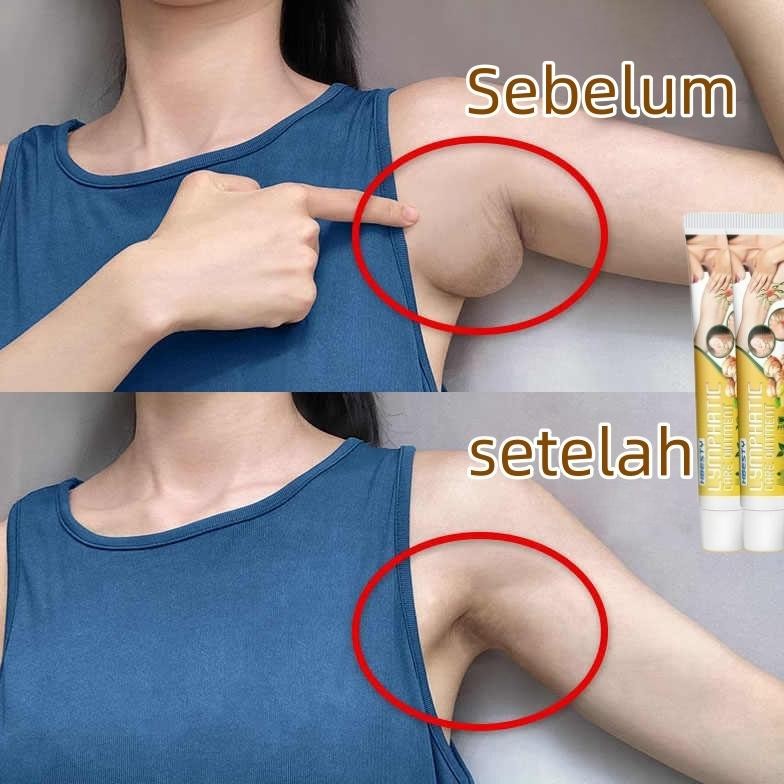 Obat Salep Cream Krim Untuk Penghilang Benjolan Kelenjar Getah Bening Lipoma lymph cream benjolan li