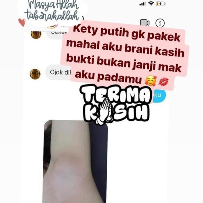 Promo / Terlaris SUYO CREAM LIPATAN Memutihkan Ketiak Selangkangan Kaki Terbaik