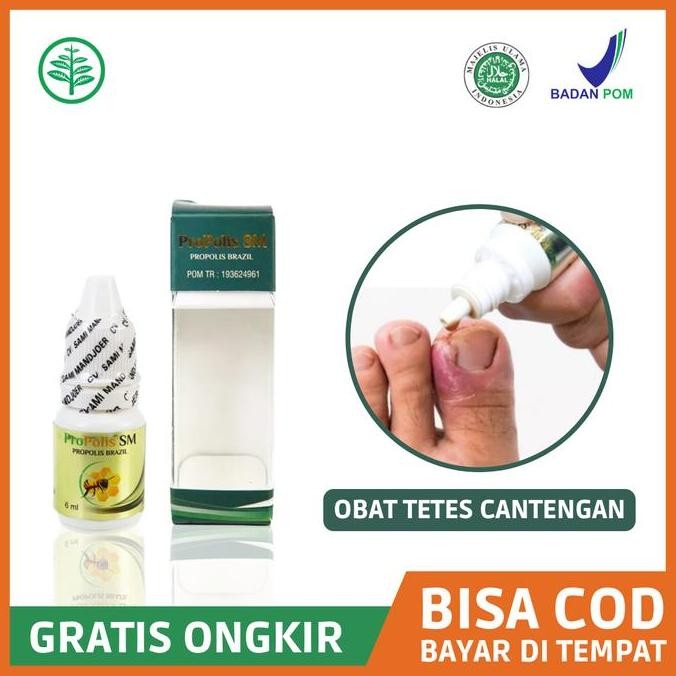 NEW Obat Jempol Kaki Bengkak Bernanah, Obat Cantengan Propolis SM Ori BPOM
