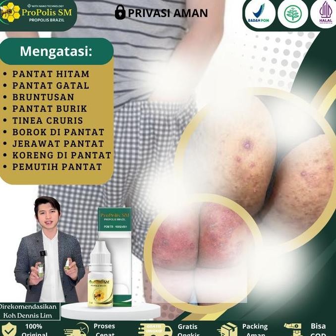 BEBAS ONGKIR - Propolis SM - Salep Gatal Pantat, Pantat Hitam burik, pantat beruntusan, Tinea Cruris