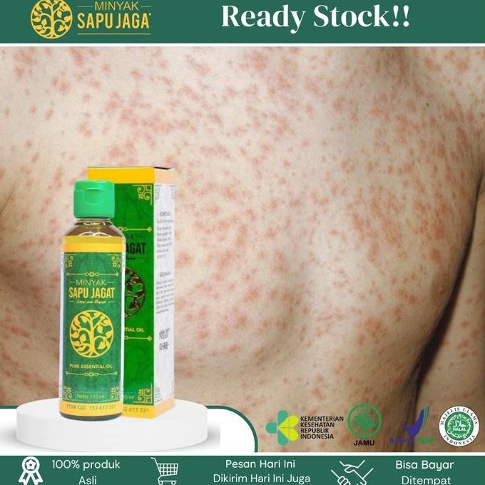 Gatal-Gatal Di Seluruh Badan, Alergi Semen, Gatal-Gatal Pada Bagian Kaki Tangan Dan Tubuh, Alergi Ma