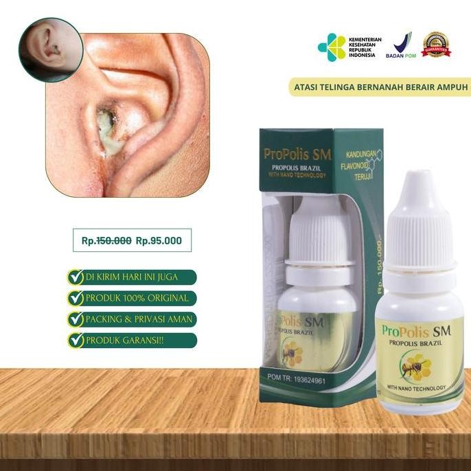 Asli Propolis SM Tetes Congek Bernanah Obat Telinga Berair, Bau Busuk, Infeksi Anak & Dewasa
