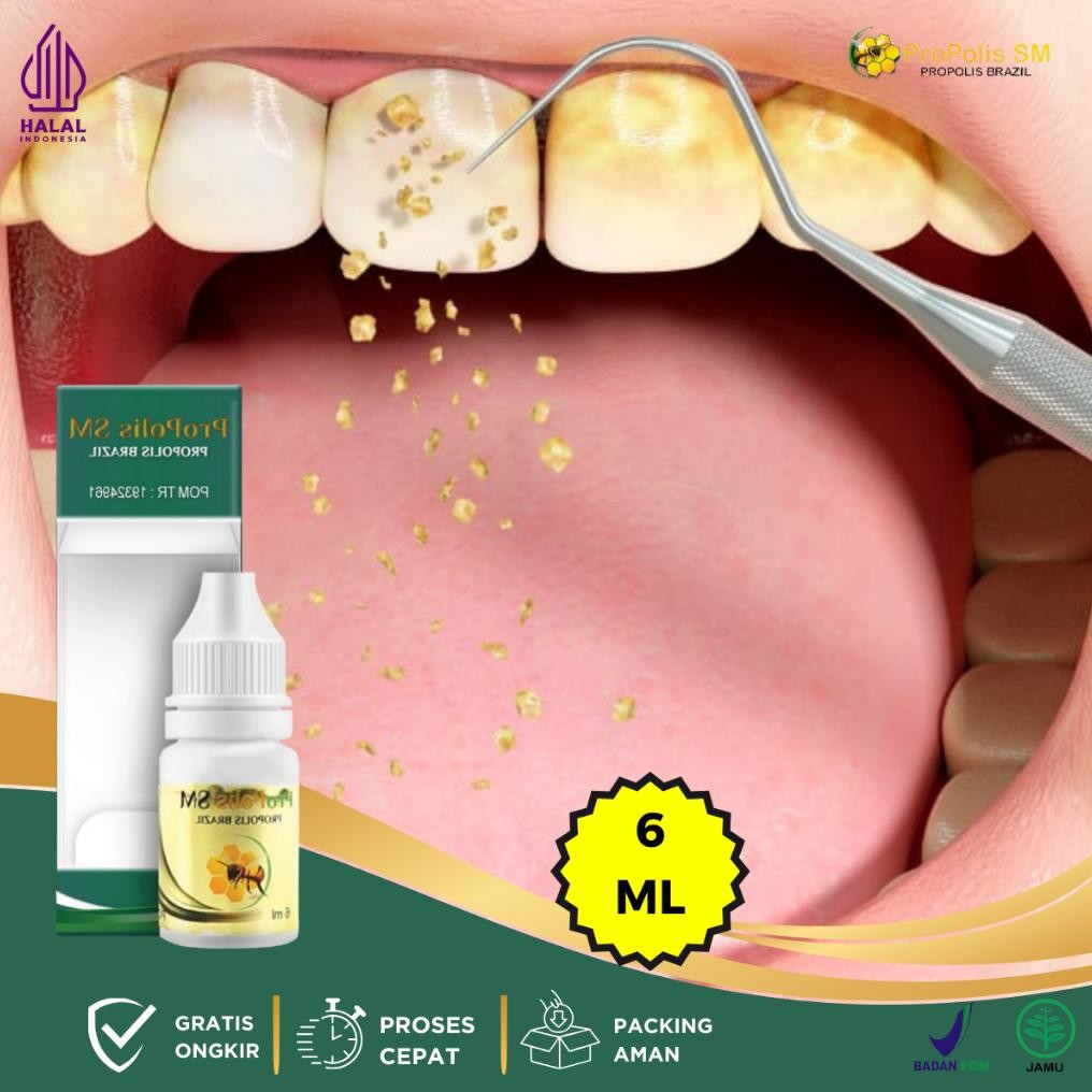 Obat Herbal Karang Gigi Ulat Gigi Anti Karang Gigi Membandel Karang Gigi Dan Plak Obat Kumur Peronto