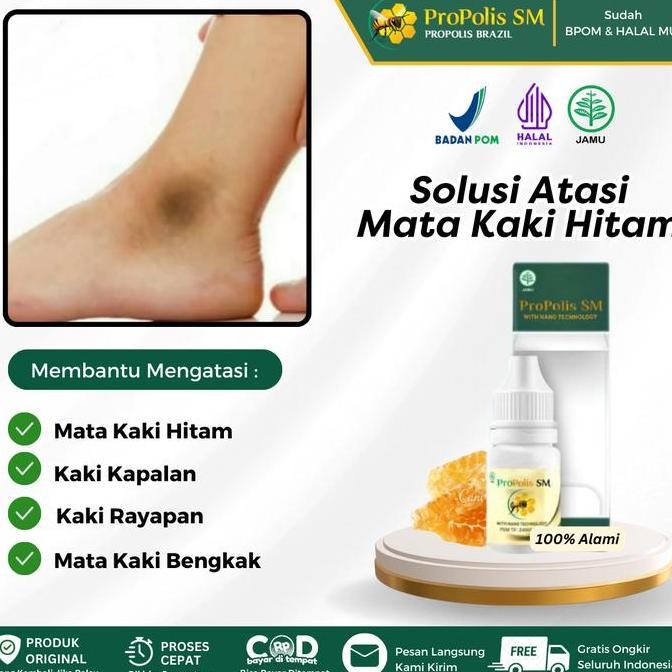 TERLARIS - Propolis SM Salep Oles Untuk Mata Kaki Hitam, Pemutih Mata Kaki Hitam, Mata Kaki Hitam da