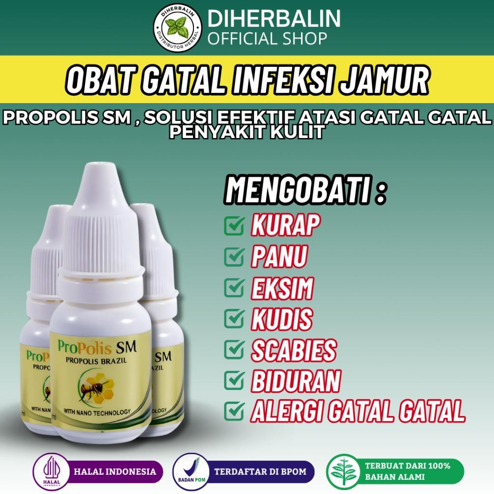 Obat Herpes Zoster, Obat Cacar Air, Salep Cacar Air, Obat Penghilang Cacar Air & Bekas Cacar bayi / 