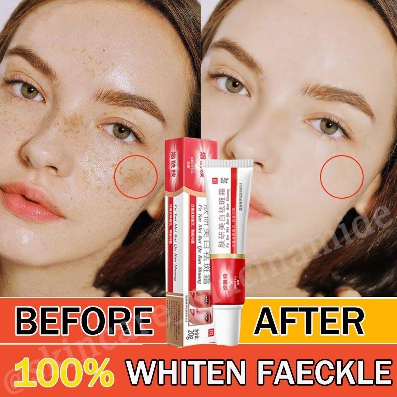 Niacinamide Salep Flek Hitam Melasma Membandel 100 % ORIGINAL Salep MURAH