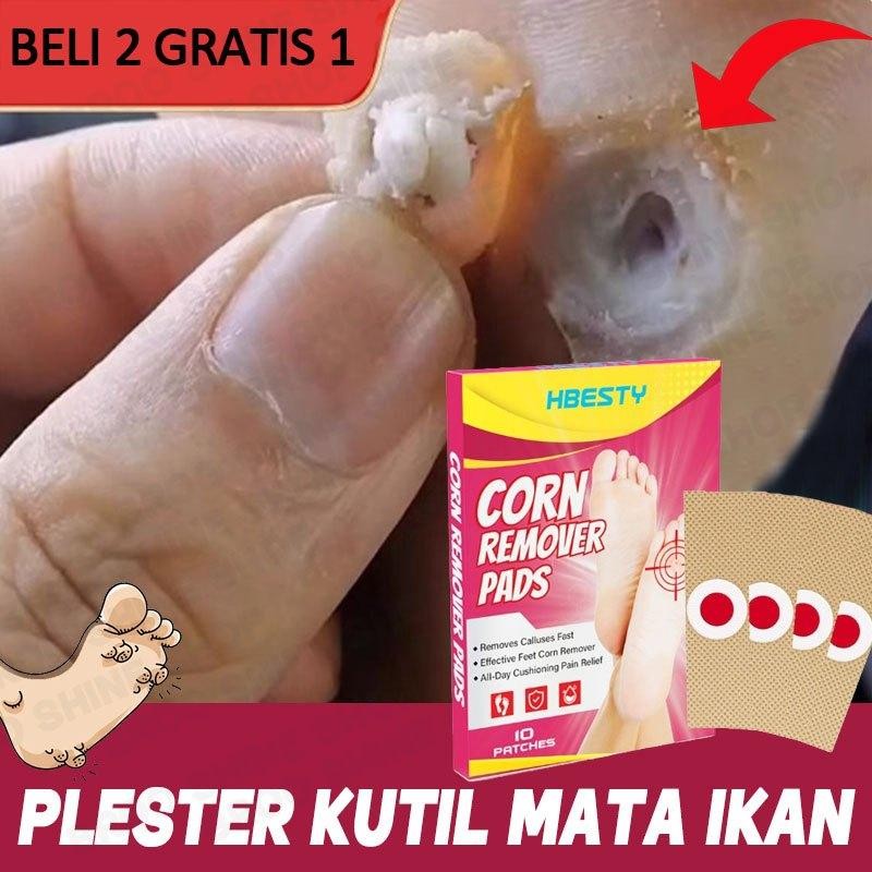 Obat Kutil Plester Mata Ikan dan Kutil plester kutil Penghilang Kutil kaki 10pcs foot corn remover S