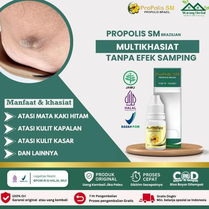 BEBAS ONGKIR - Propolis SM Untuk Mata Kaki Hitam, Menghaluskan Kaki Kasar, Salep Kulit Kaki Pecah, M