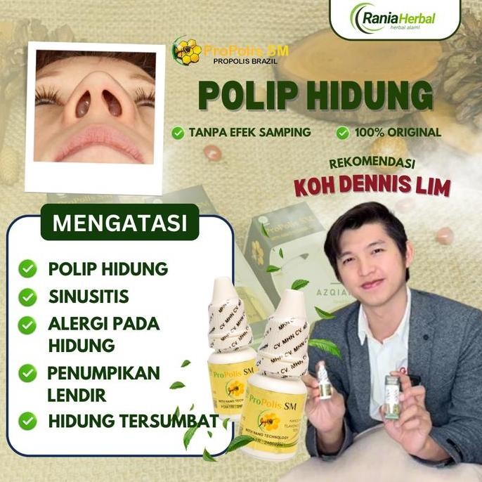 NEW Tetes Polip Hidung, Sinusitis, Rhinitis, Hidung Bau Busuk, Benjolan Salam Hidung, Hidung Tersumb