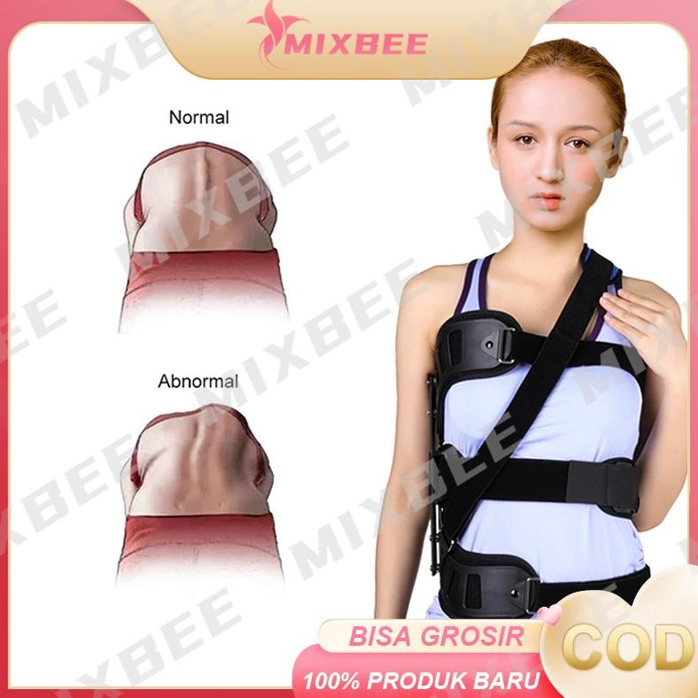 Ober scoliosis pelurus tulang belakang bengkok orthosis fiksasi terapi pasca operasi skoliosis korek