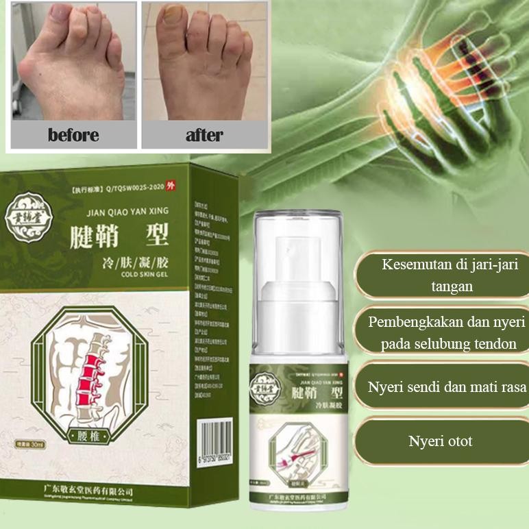 APGAR Spray Ampuh Menyembuhkan Nyeri Sendi Rematik Sakit Nyeri Tangan Lutut DiM