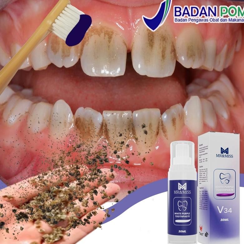 Odol pemutih gigi dan karang gigi pasta gigi pemutih Penghilang karang gigi Pemutih gigi ampuh 100% 