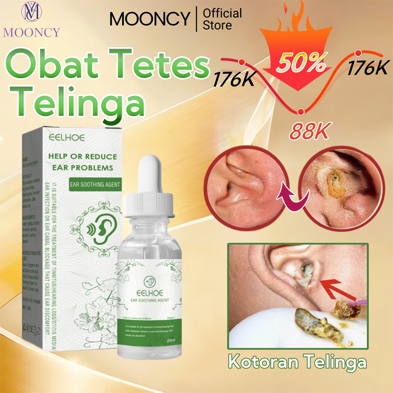 Mooncy Obat Tetes Telinga Pembersih Kotoran Pembersih Telinga Bayi Obat Sakit Telinga Bernanah Berai