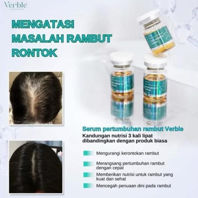 Verble Serum Penumbuh Rambut Verble Hair Growth Serum Impressive Hair Loss Treatment