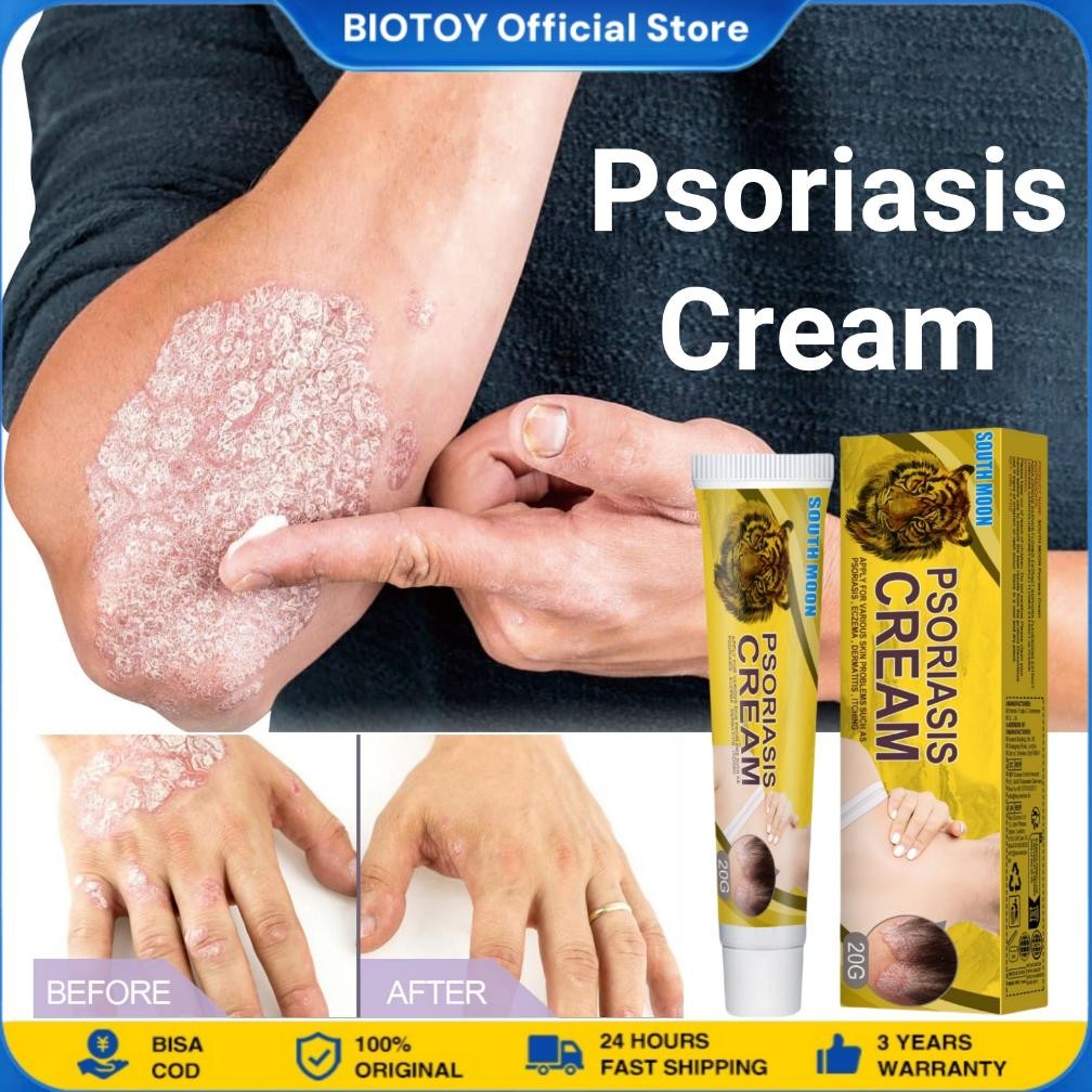 Salep Gatal Cream Psoriasis Salep Eksim Kering Krim Psoriasis Paling Ampuh Original Obat Eksim Mengh