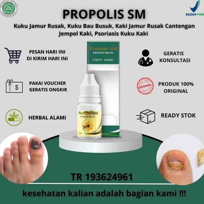 TERBARU - Propolis SM - Kuku Jamur Rusak, Kuku Bau Busuk, Kaki Jamur Rusak Cantengan Jempol Kaki, Ps