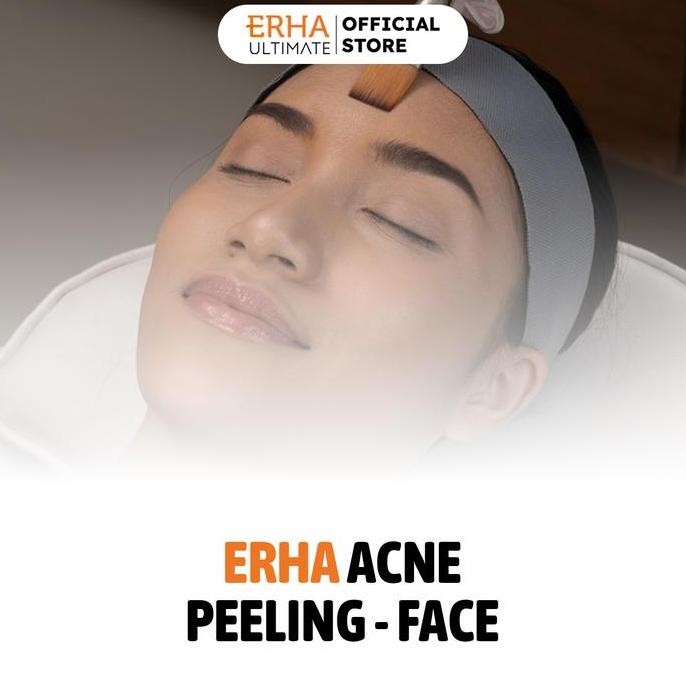 TERLARIS - ERHA Acne Peeling for Face