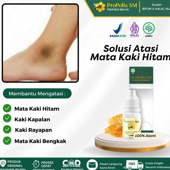 TERBARU - Propolis SM Salep Oles Untuk Mata Kaki Hitam, Pemutih Mata Kaki Hitam, Mata Kaki Hitam dan