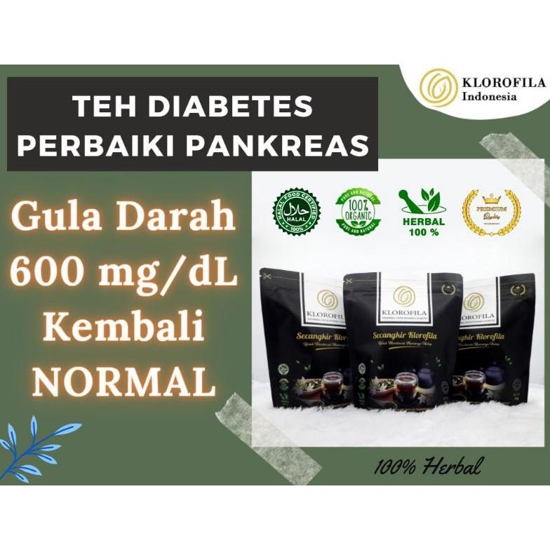 

(Terbaru) Teh Klorofila Herbal Diabetes [ PROMO - 3 Pcs KLOROFILA ] - ORI - Obat Herbal Diabetes Ampuh Perbaikan Pankreas . Herbal Diabetes Ampuh . Herbal Diabetes Kronis . Obat Gula Terbaik . HbA1c . Obat Diabetes Ampuh . Jamu Terbaik . (Terlaris)