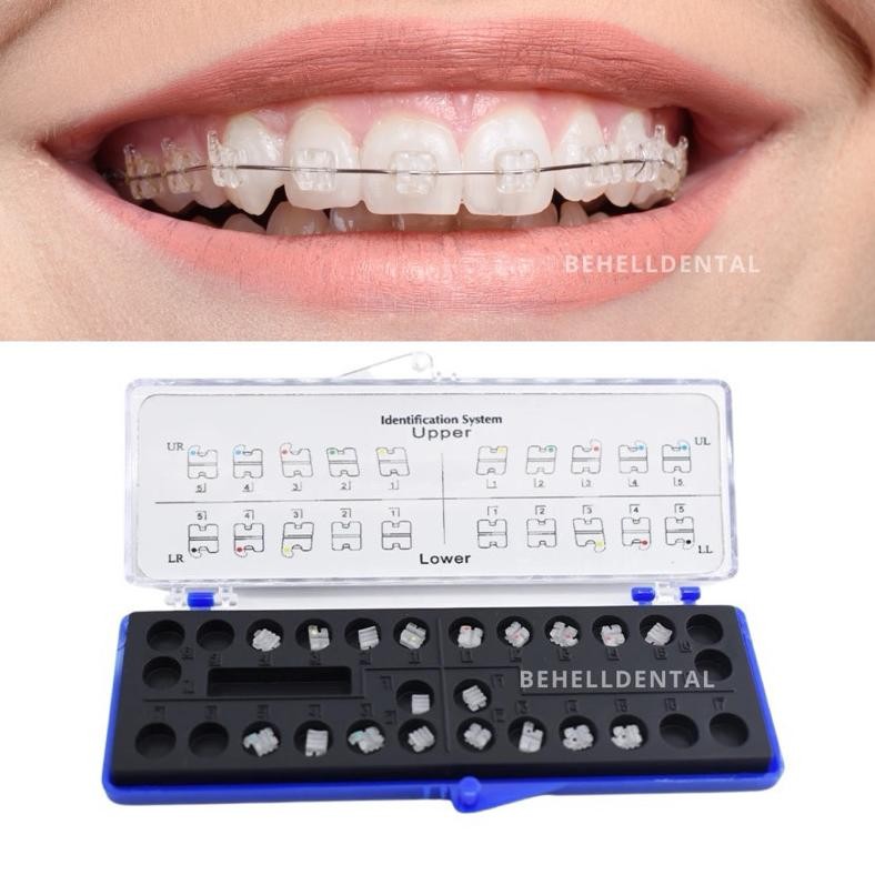 BRACKET BEHEL CERAMIC CLEAR TRANSPARAN ORTHODONTIC ORTHOMERICA - BRACES Permanen American Roth Hook 