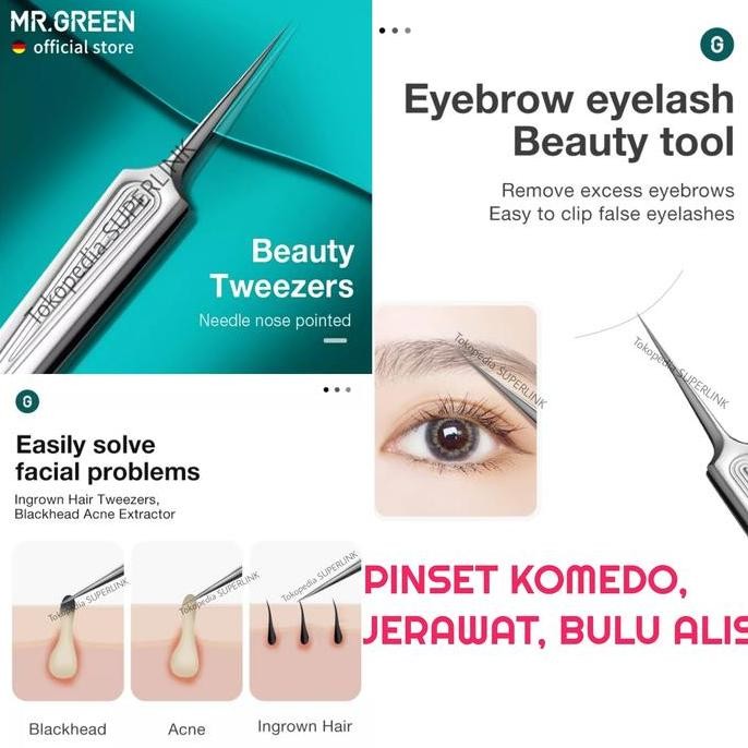 Promo MR. GREEN Pinset Komedo Tweezer Acne Needle Jerawat Soligen Germany COD