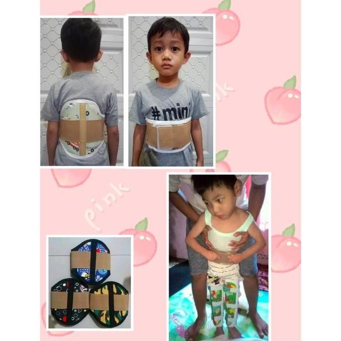 Korset anak karakter (korset tulang belakang) BS76