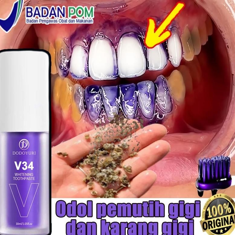 Odol pemutih gigi dan karang gigi Perontok karang gigi paling ampuh Pasta gigi pemutih penghilang ka