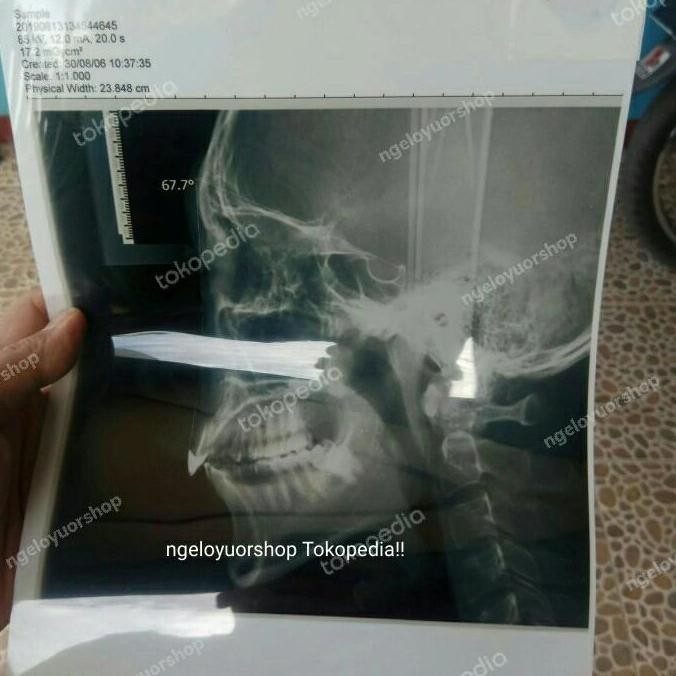 

TERBARU - paper yc film inkjet Rontgen paper film ronses A4