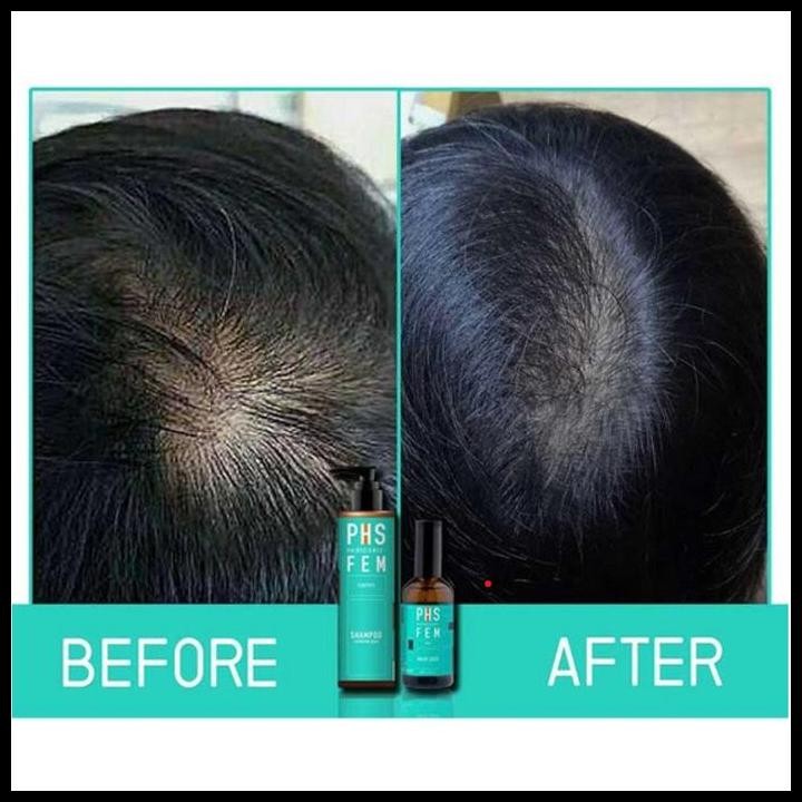 Terlaris Phs Hairscience Fem Fortify Shampoo For Hair Loss Good Quality