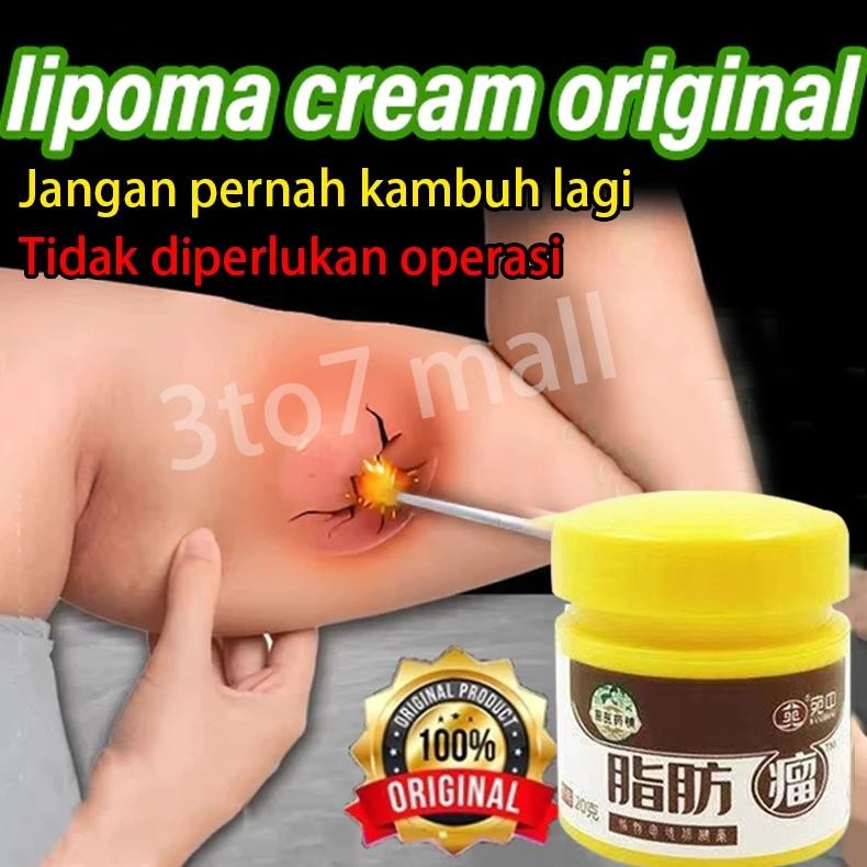 lipoma cream original Salep Obat Cream Lipoma Penghilang Lemak removal Benjolan 20g lipoma removal c