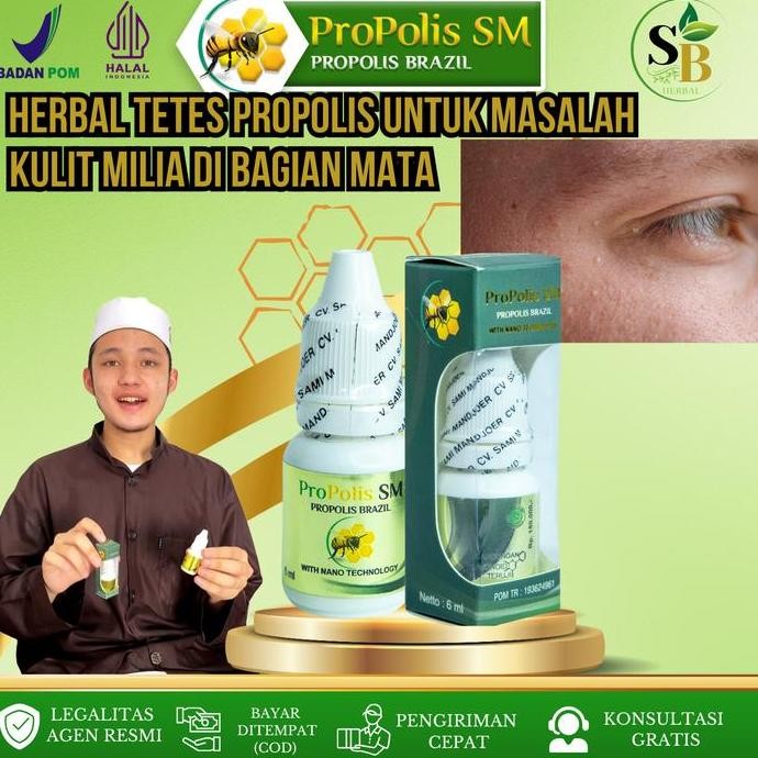 PROPOLIS SM - Cream Milia, Salep Milia, Penghilang Milia Dengan Cepat