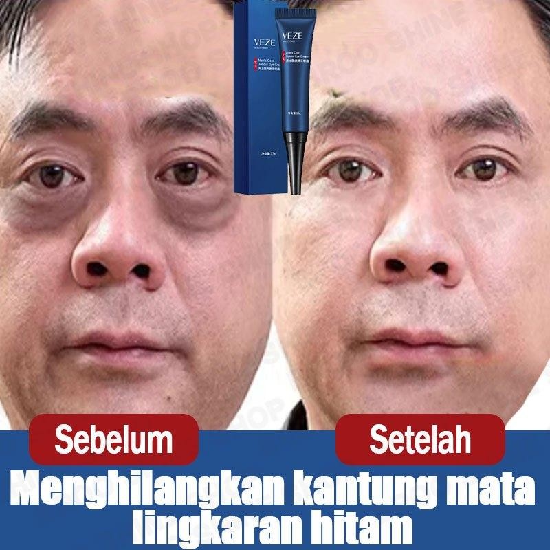 Kantung Mata Hilang Ampuh Cream Penghilang Kantung Mata Krim Mata Panda Dan Kantung Mata Cream Mata 