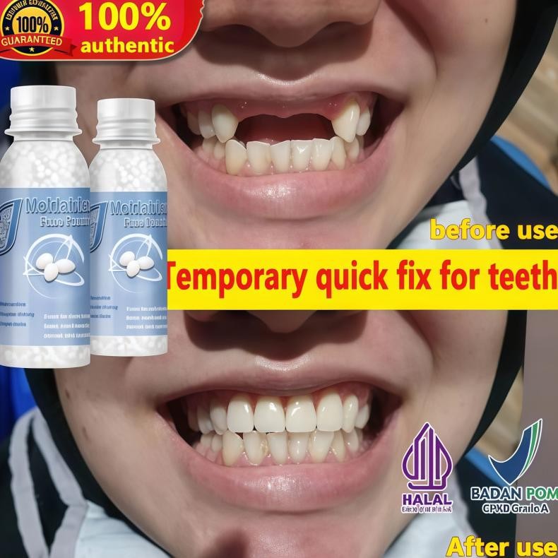 30ML Penambal gigi berlubang gigi palsu asli dokter permanen tambal gigi permanen  lem gigi palsu pe