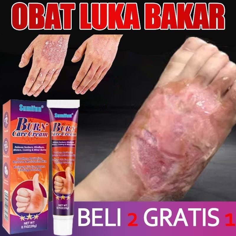 Salep Luka Bakar Paling Ampuh Obat Luka Bakar Salep Bekas Luka Bakar Penghilang Bekas Luka Bakar Men