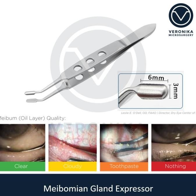 MEIBOMIAN GLAND EXPRESSOR COMPRESSOR