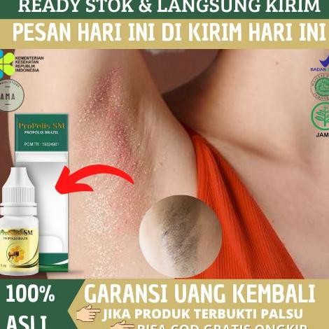 Oles Ketiak Hitam Dan Gatal Iritasi Ruam Bruntusan Dan Bisul Di Ketiak Dengan Propolis SM Brazil