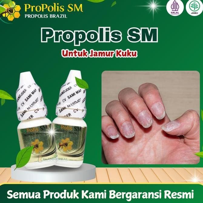 NEW Jamur Kuku, Cantengan jempol Kuku, Kuku bernanah, Kuku berair, Psoriasis Kuku Propolis SM 6 ml
