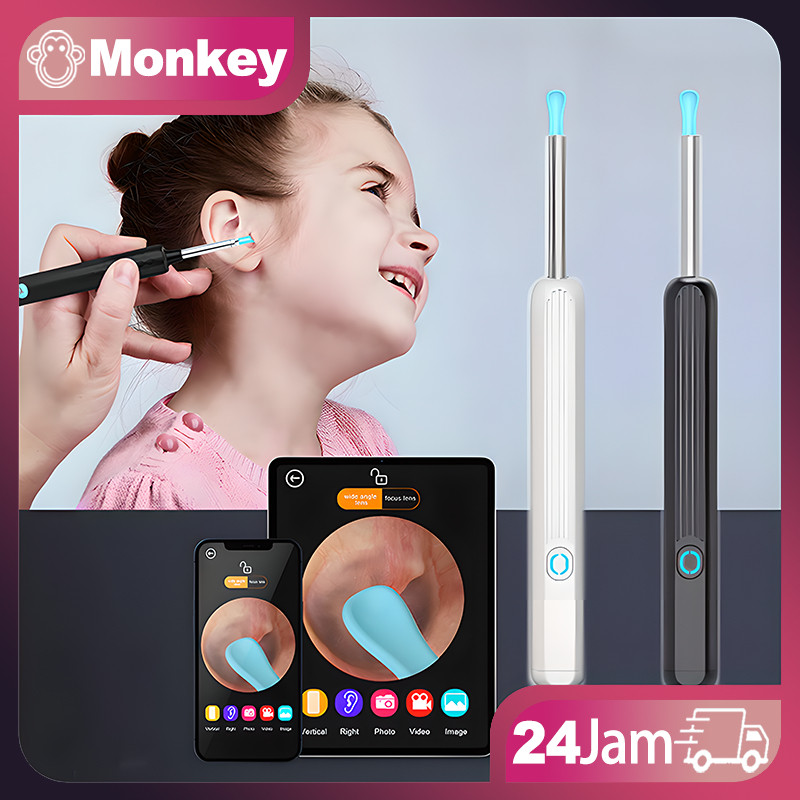 Pembersih Telinga Bayi Korek Kuping Pembersih Kuping Smart Led Kamera Wifi Hp Korek Kuping Bayi