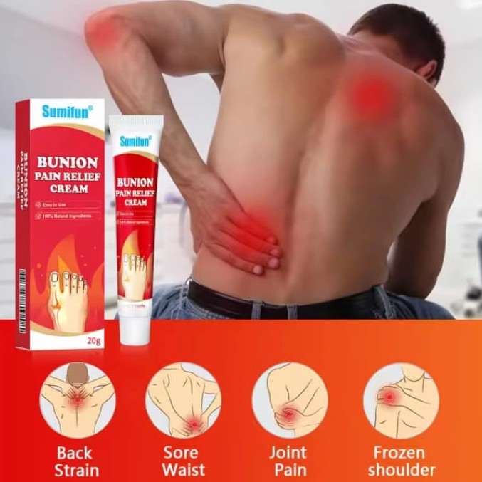 Salep Bunion cream nyeri sendi/Sumifun Arthritis bunion relief cream