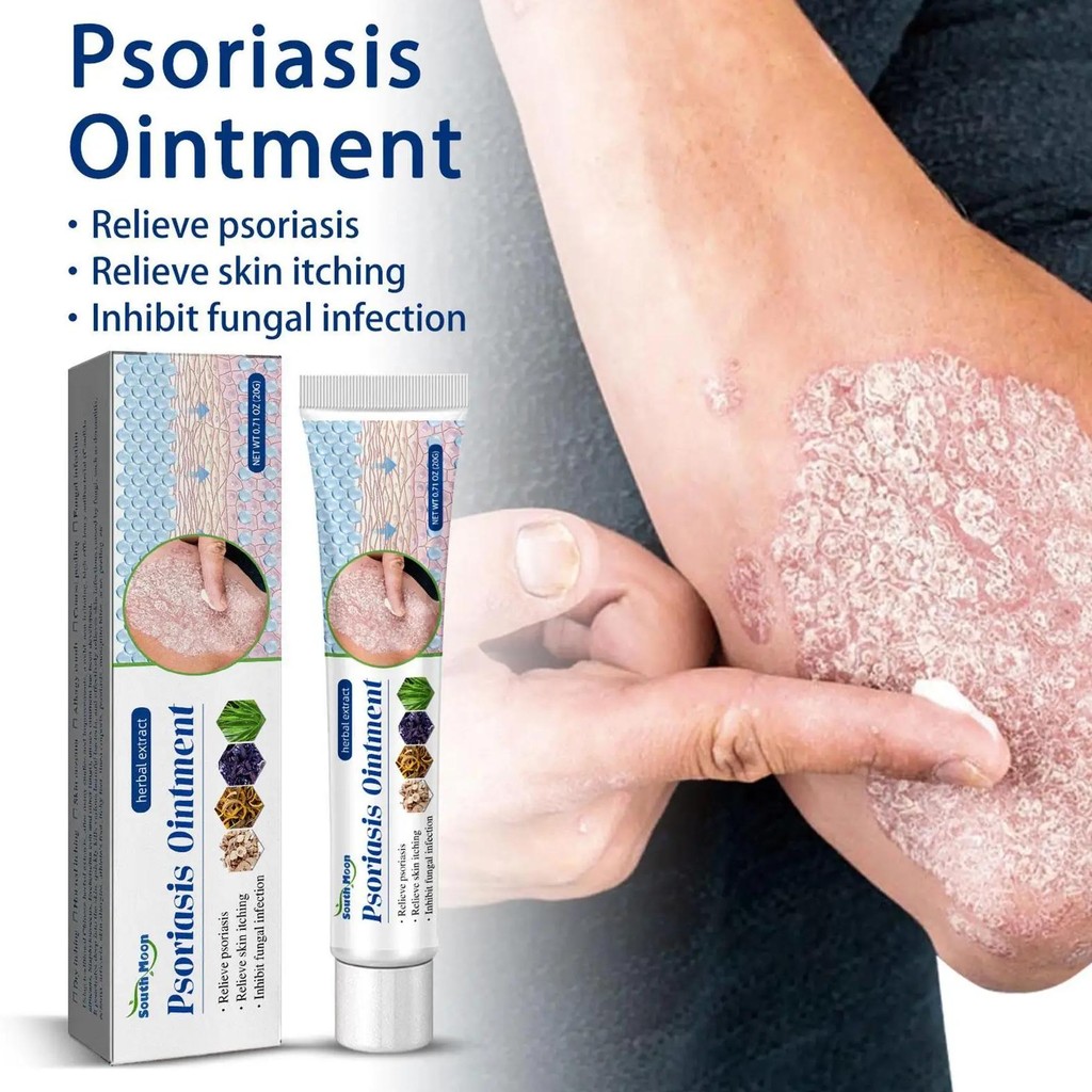 herbal psoriasis treatment cream antibacterial anti-itch dermatiti eczema urticaria alergy skin oint